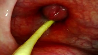 Kamera Götünün Içine Girerken, Koca Bir Aletle Delik Deşik Ediliyor.