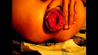 Masöz, Pelvik Organ Prolapsusu Semptomlarını Hafifletmeye Yardımcı Oluyor